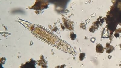 Kuruyup Yeniden Canlanan ve DNA’sını Onaran Canlı: Bdelloid Rotifer