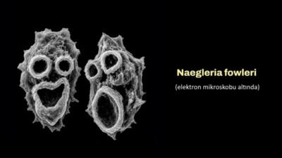 Naegleria Fowleri Nedir? Beyin Yiyen Amip Hakkında Bilmeniz Gerekenler